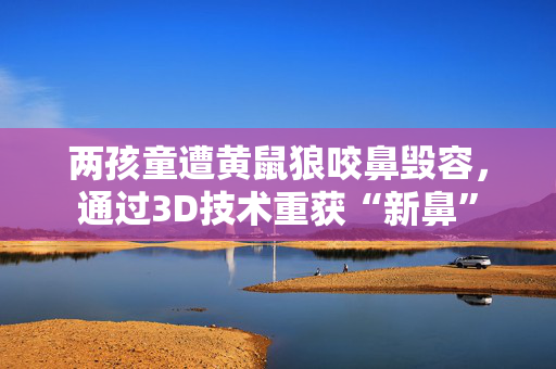 两孩童遭黄鼠狼咬鼻毁容，通过3D技术重获“新鼻”